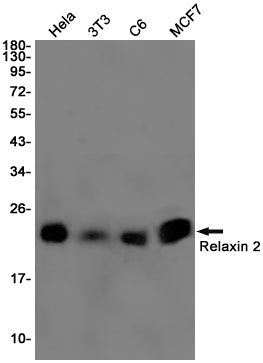 Relaxin 2 Rabbit Monoclonal Antibody