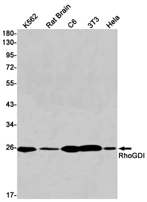 RhoGDI Rabbit Monoclonal Antibody