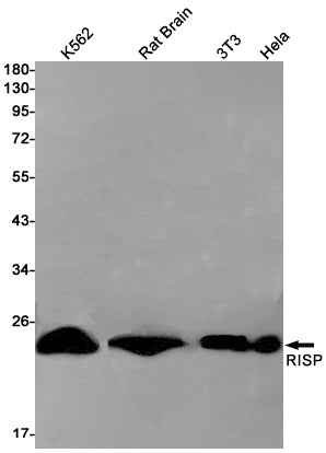 Complex III Subunit 5 Rabbit Monoclonal Antibody