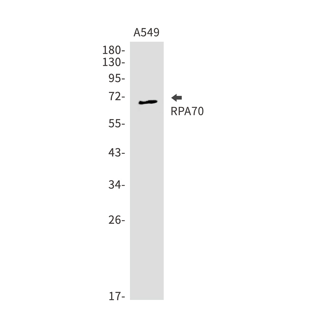 RPA70 Rabbit Monoclonal Antibody