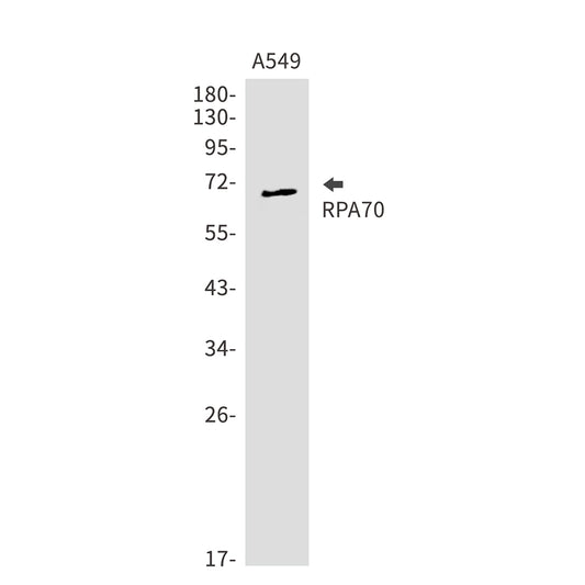 RPA70 Rabbit Monoclonal Antibody