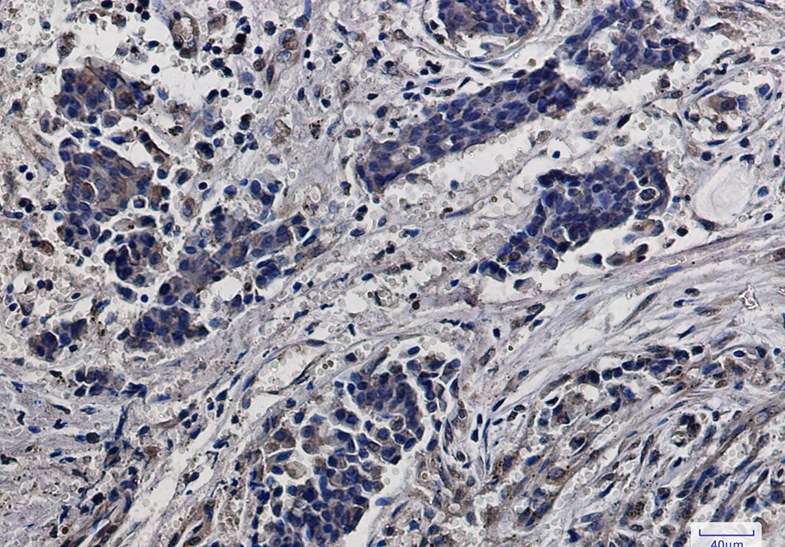 RPS6 Rabbit Monoclonal Antibody