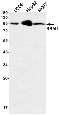 RRM1 Rabbit Monoclonal Antibody