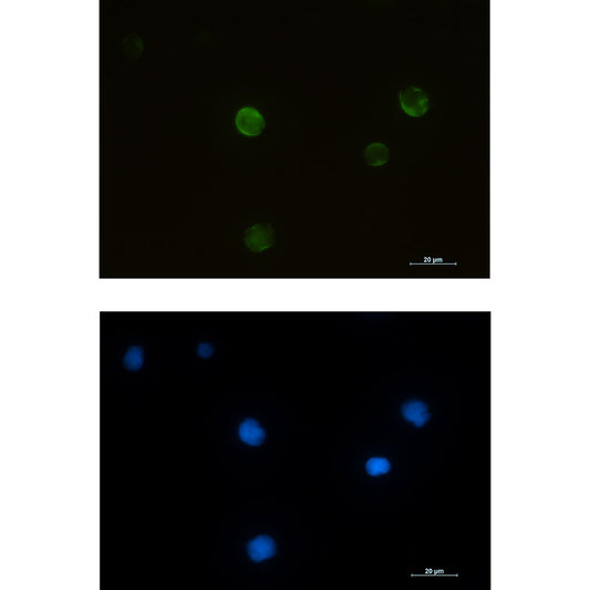 RRM2 Rabbit Monoclonal Antibody