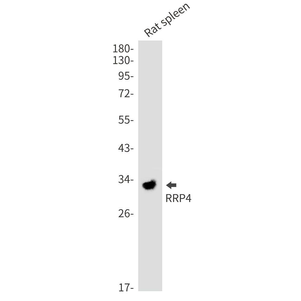 RRP4 Rabbit Monoclonal Antibody