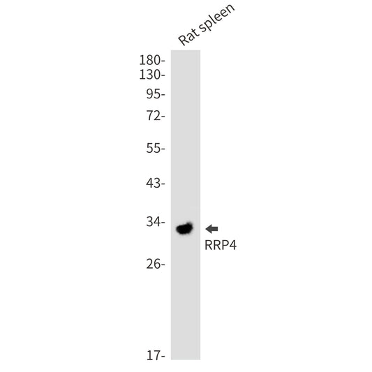 RRP4 Rabbit Monoclonal Antibody