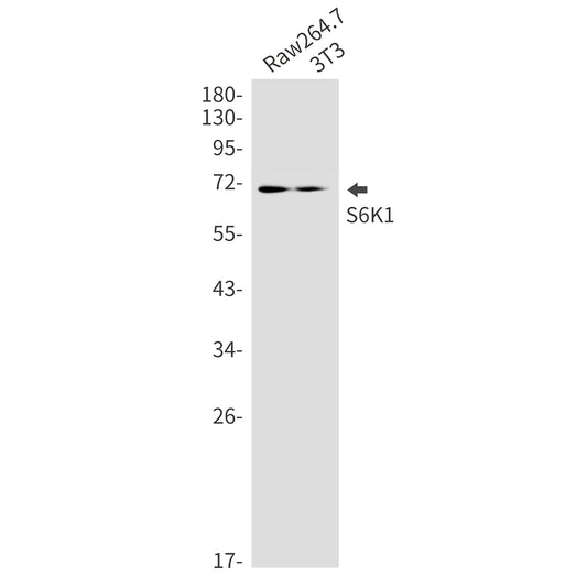 S6K1 Rabbit Monoclonal Antibody