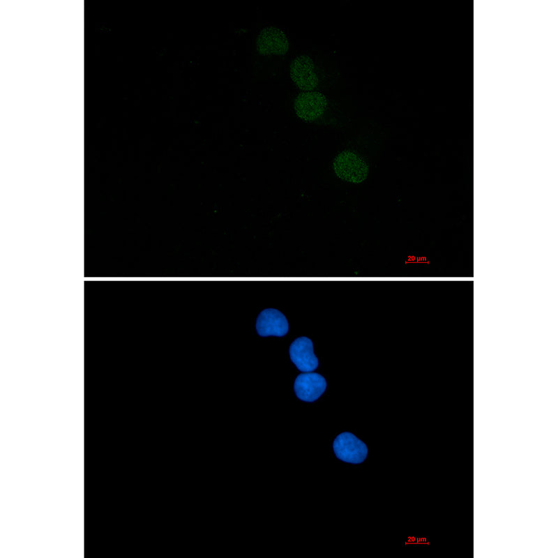 SAE1 Rabbit Monoclonal Antibody
