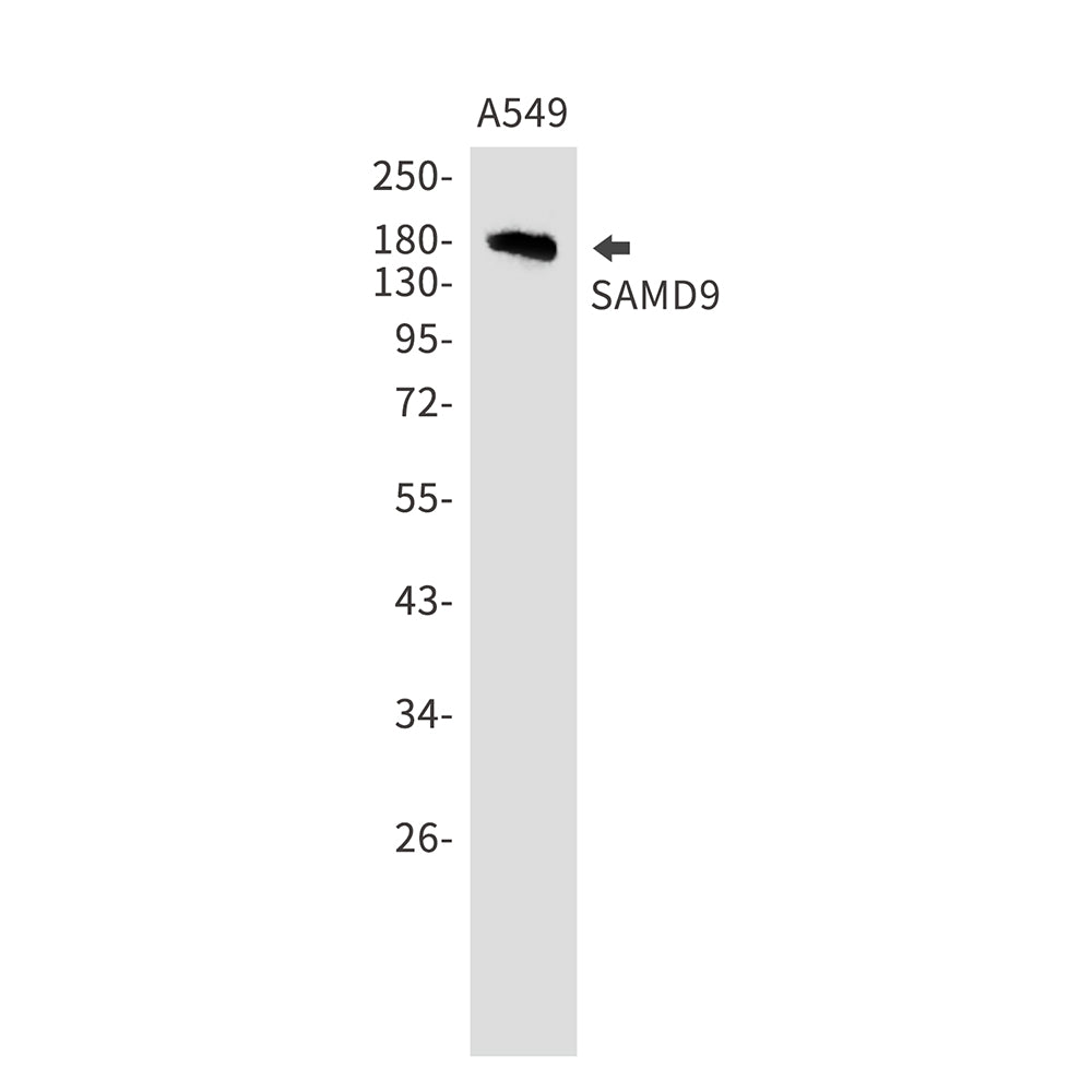 SAMD9 Rabbit Monoclonal Antibody