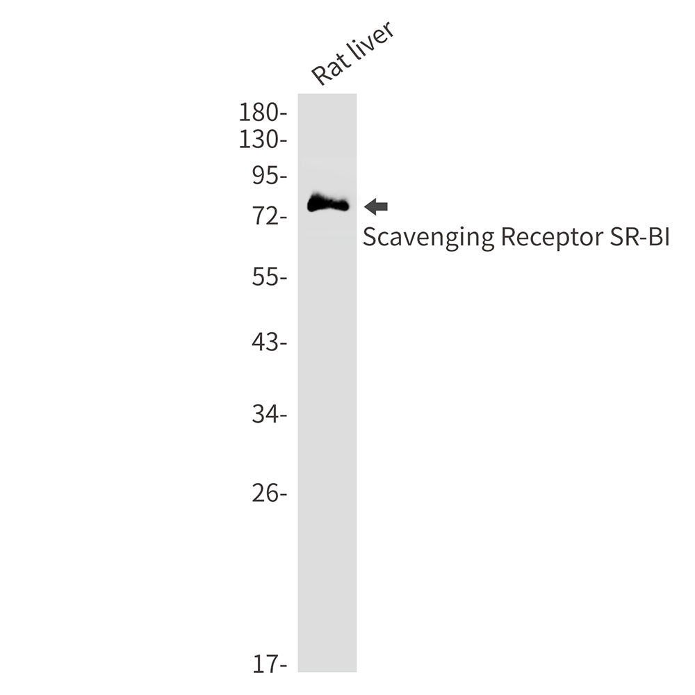 SCARB1 Rabbit Monoclonal Antibody