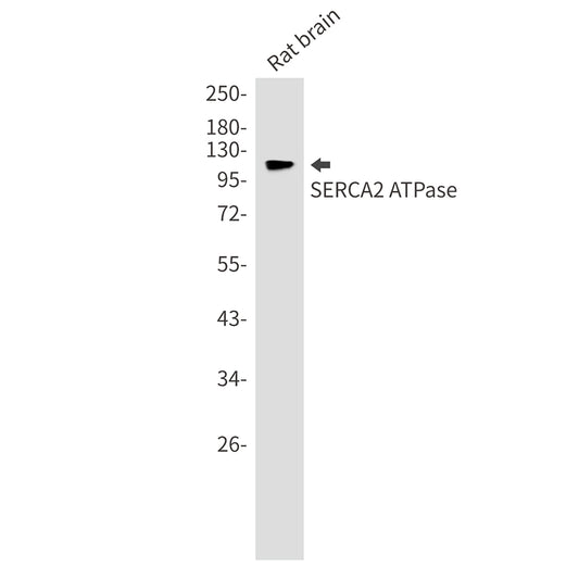 SERCA2 ATPase Rabbit Monoclonal Antibody