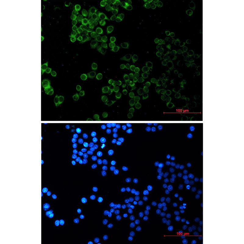 SESN2 Rabbit Monoclonal Antibody