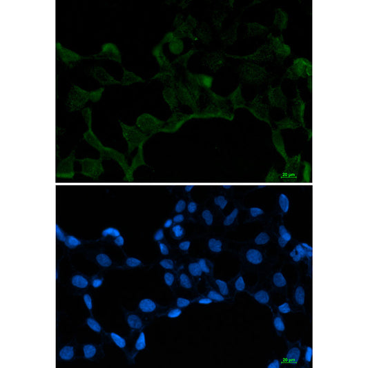 SF2 Rabbit Monoclonal Antibody