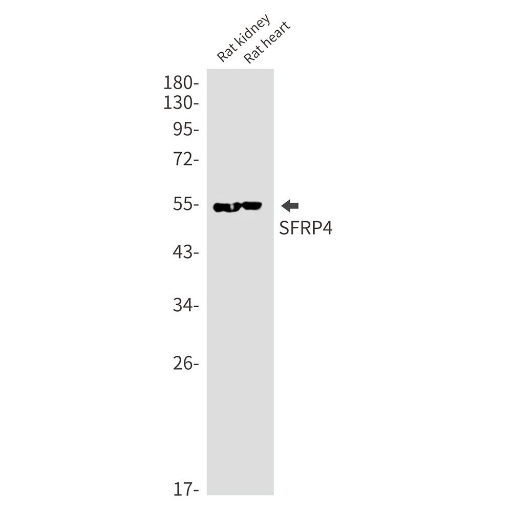 SFRP4 Rabbit Monoclonal Antibody