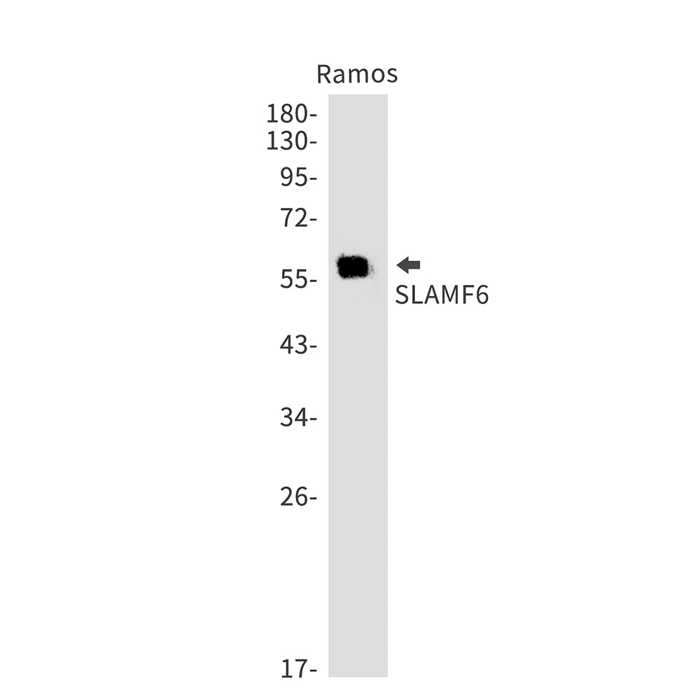 SLAMF6 Rabbit Monoclonal Antibody