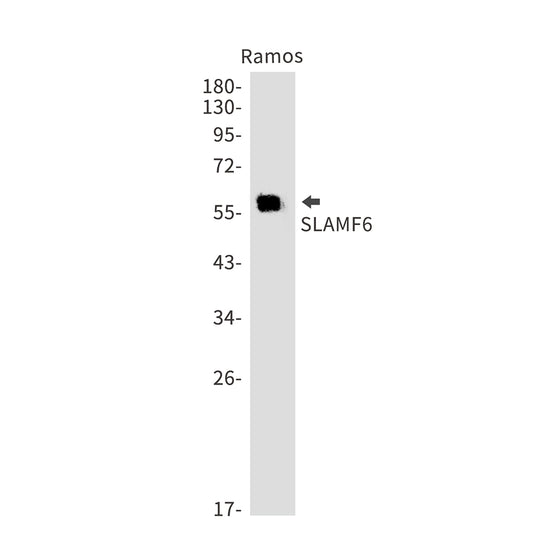 SLAMF6 Rabbit Monoclonal Antibody