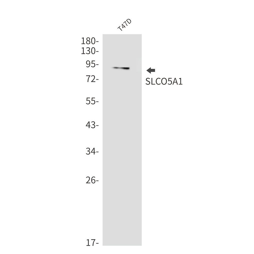 SLCO5A1 Rabbit Monoclonal Antibody