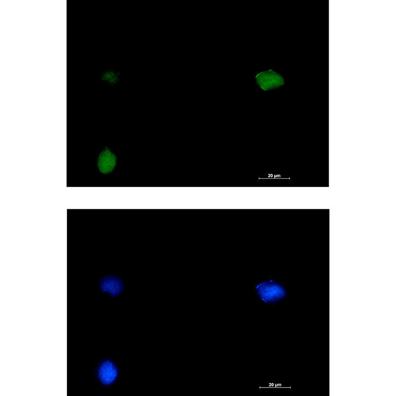 SMARCC1 Rabbit Monoclonal Antibody