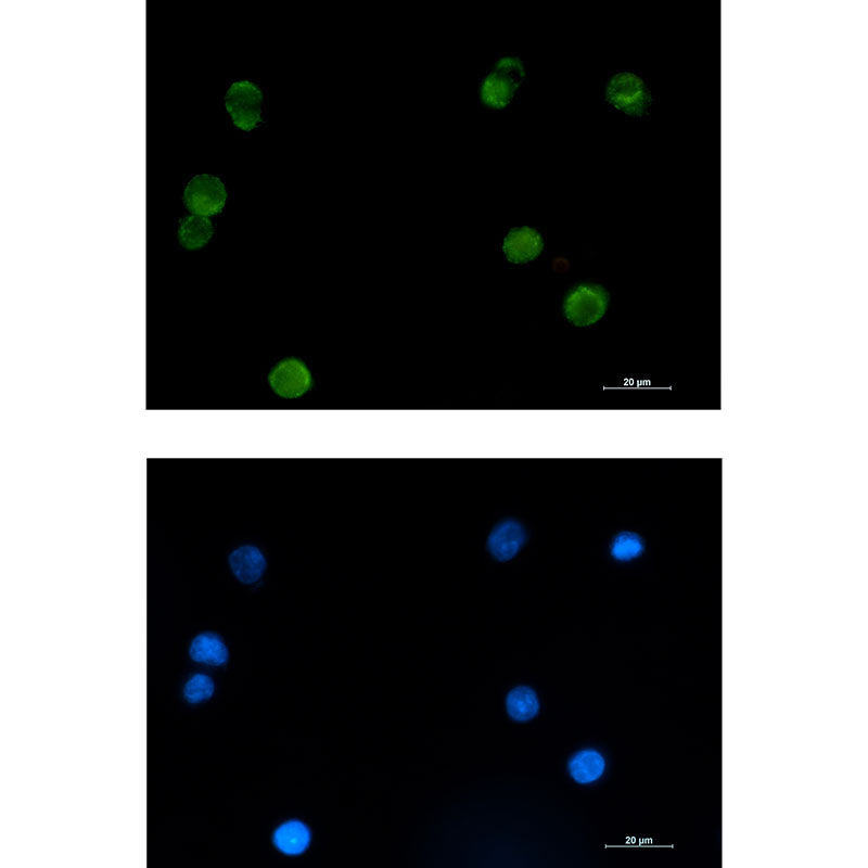 SMYD3 Rabbit Monoclonal Antibody