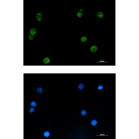 SMYD3 Rabbit Monoclonal Antibody