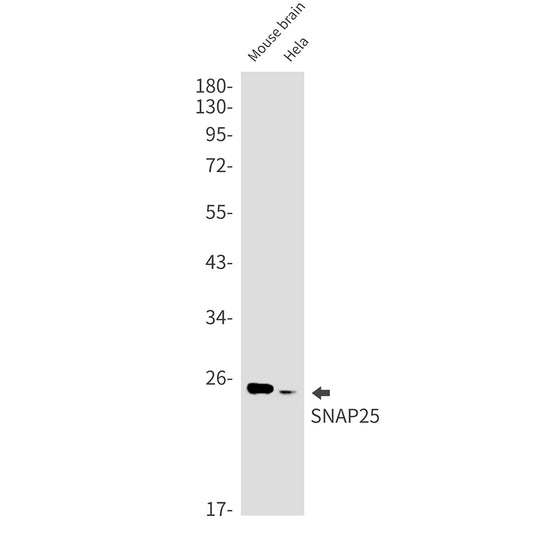 SNAP25 Rabbit Monoclonal Antibody