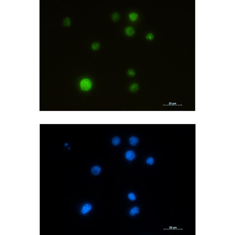 SMARCA5 Rabbit Monoclonal Antibody