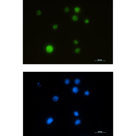SMARCA5 Rabbit Monoclonal Antibody