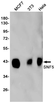 SMARCB1 Rabbit Monoclonal Antibody