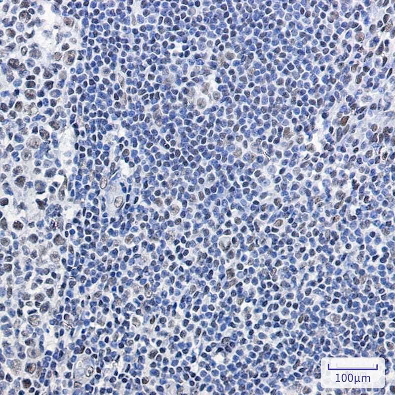 SMARCB1 Rabbit Monoclonal Antibody