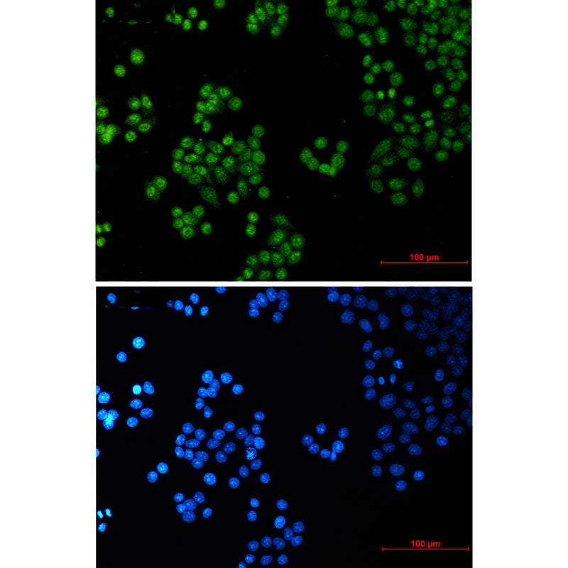 SP1 Rabbit Monoclonal Antibody