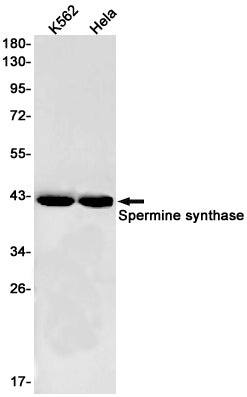 Spermine Synthase Rabbit Monoclonal Antibody
