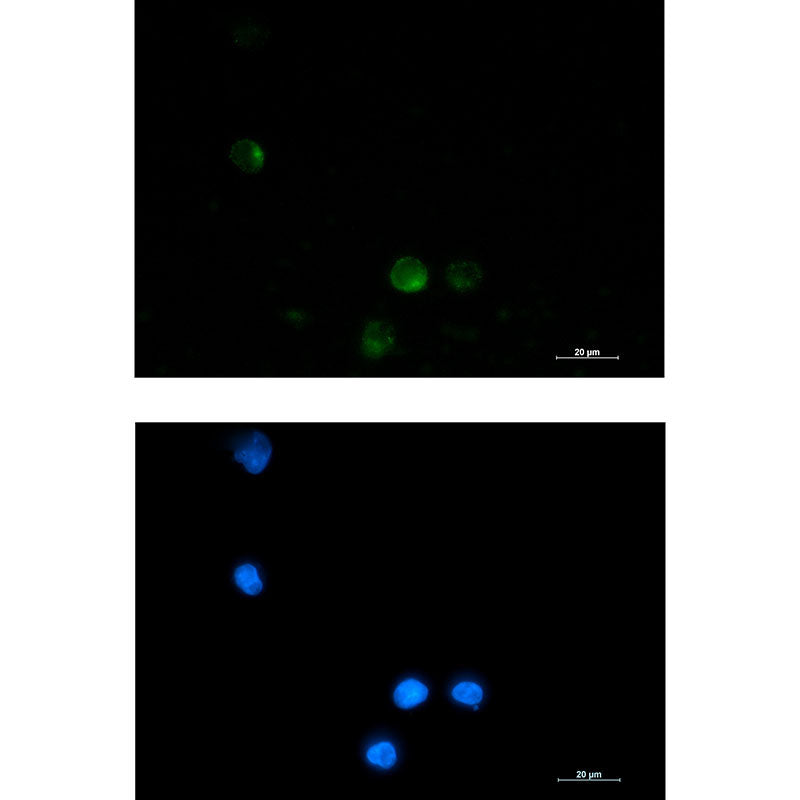 SSX2IP Rabbit Monoclonal Antibody