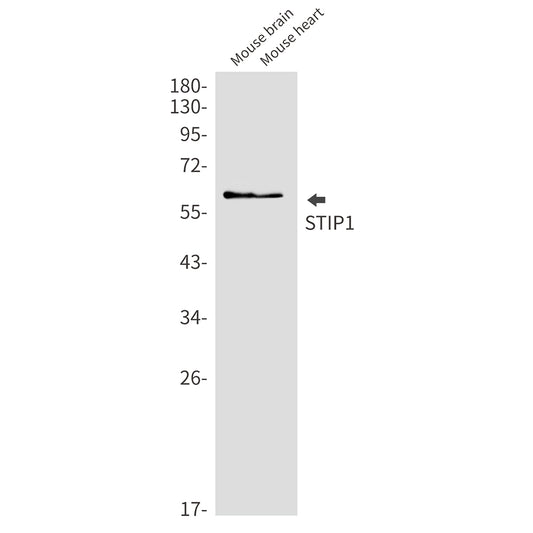 STIP1 Rabbit Monoclonal Antibody