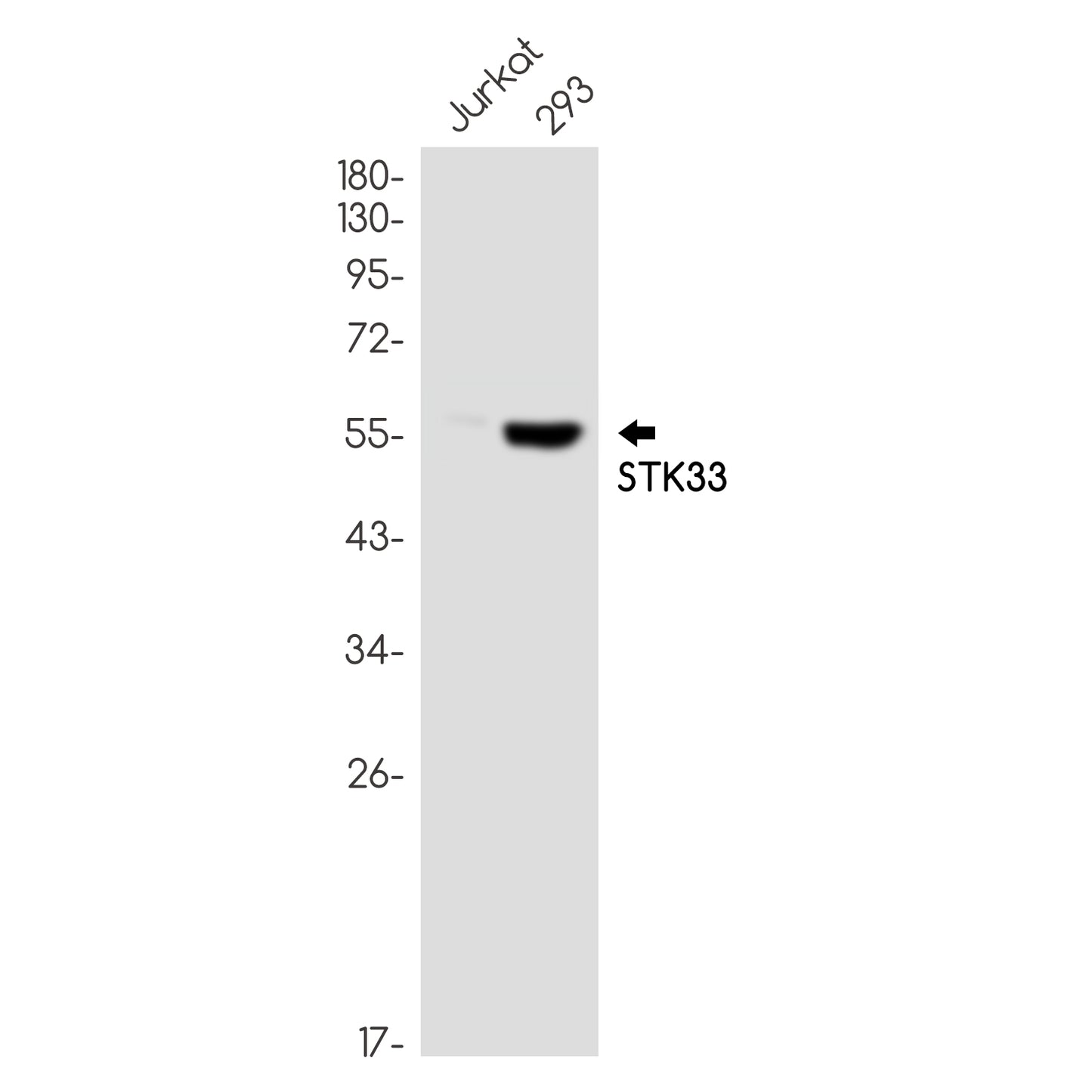STK33 Rabbit Monoclonal Antibody