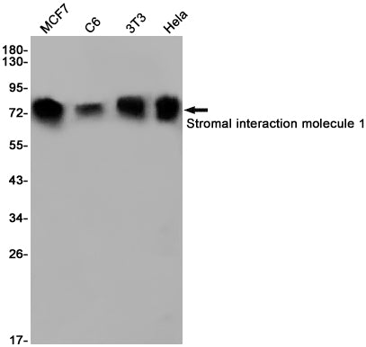 Stromal Interaction Molecule 1 Rabbit Monoclonal Antibody