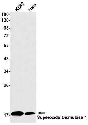 Superoxide Dismutase 1 Rabbit Monoclonal Antibody