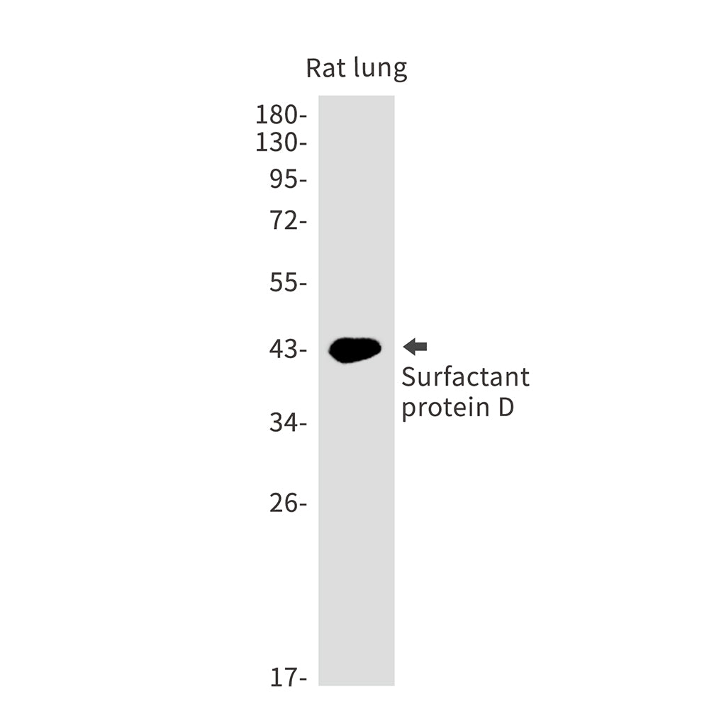Pulmonary Surfactant Associated Protein D Rabbit Monoclonal Antibody