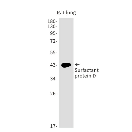 Pulmonary Surfactant Associated Protein D Rabbit Monoclonal Antibody