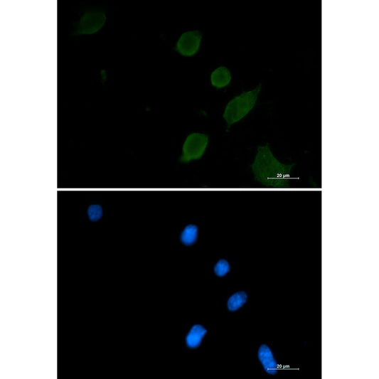 Synaptophysin Rabbit Monoclonal Antibody