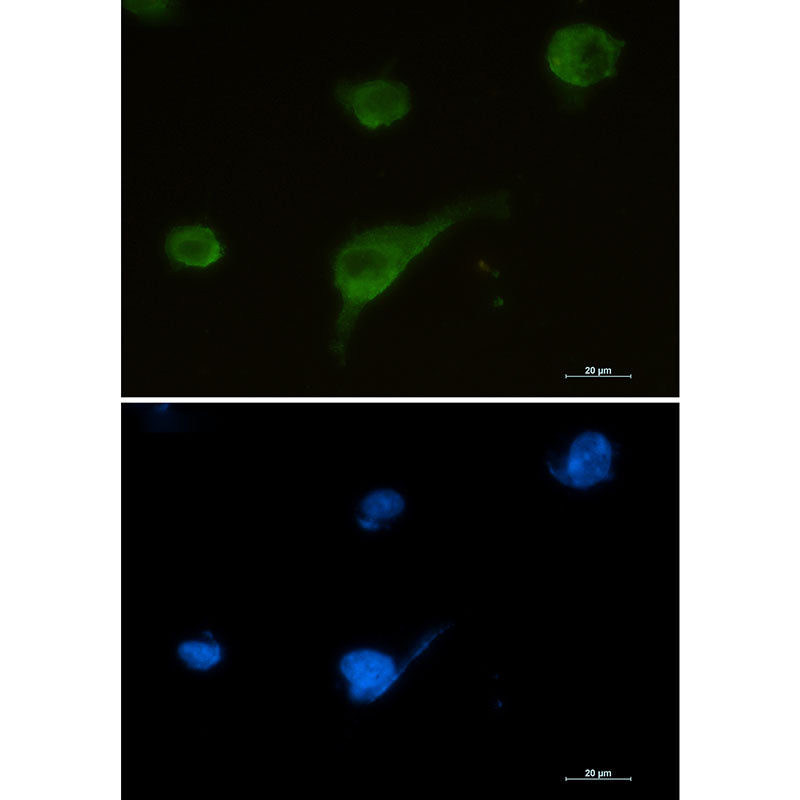 Syntrophin alpha 1 Rabbit Monoclonal Antibody