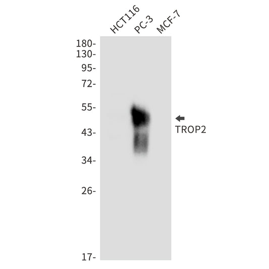 TACSTD2 Rabbit Monoclonal Antibody