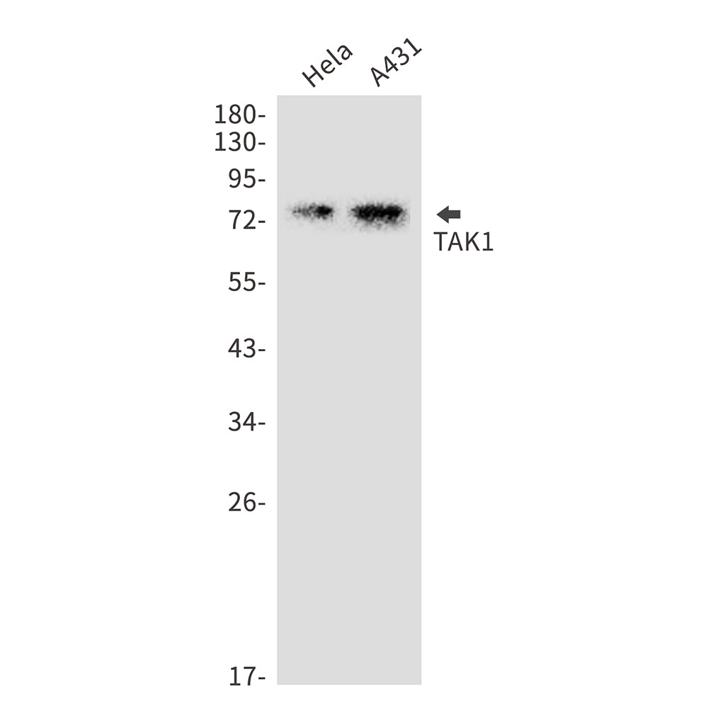 TAK1 Rabbit Monoclonal Antibody