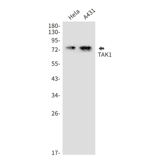 TAK1 Rabbit Monoclonal Antibody