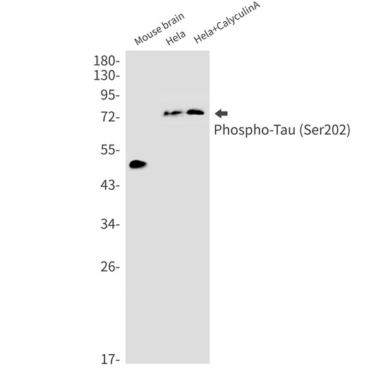 Phospho-Tau (Ser202) Rabbit Monoclonal Antibody