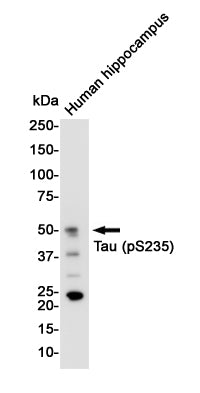 Phospho-Tau (Ser235) Rabbit Monoclonal Antibody
