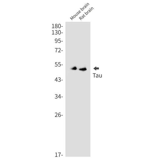 Tau Rabbit Monoclonal Antibody