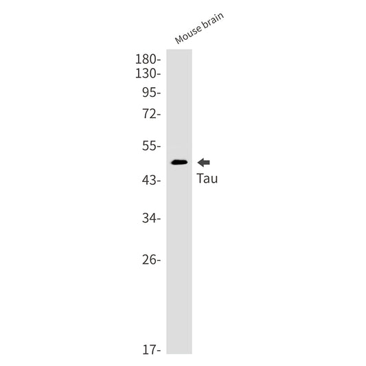 Tau Rabbit Monoclonal Antibody