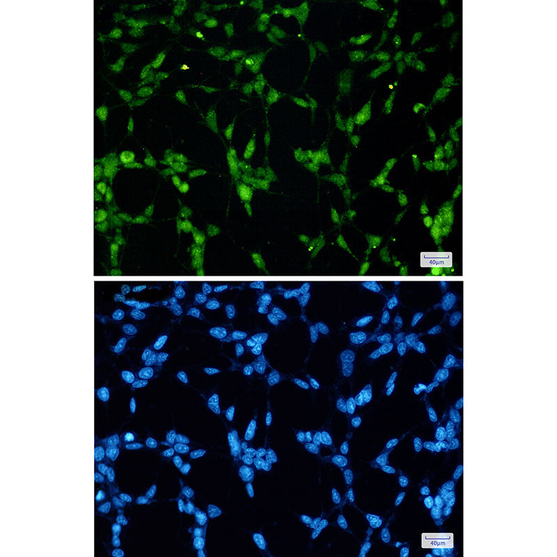 TDP 43 Rabbit Monoclonal Antibody