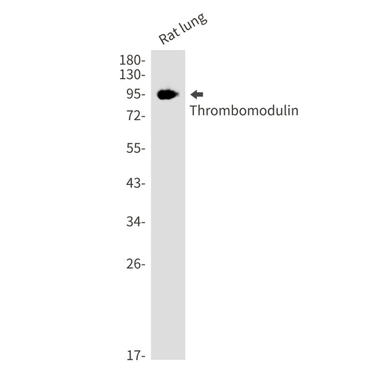 Thrombomodulin Rabbit Monoclonal Antibody