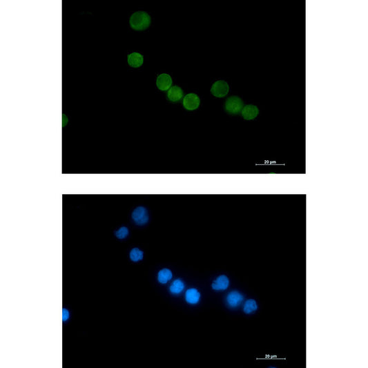 Thymidylate Synthase Rabbit Monoclonal Antibody
